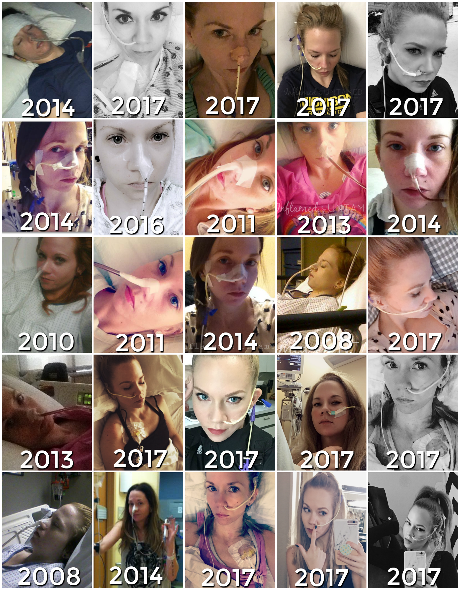 picture-2-ng-tube-blog